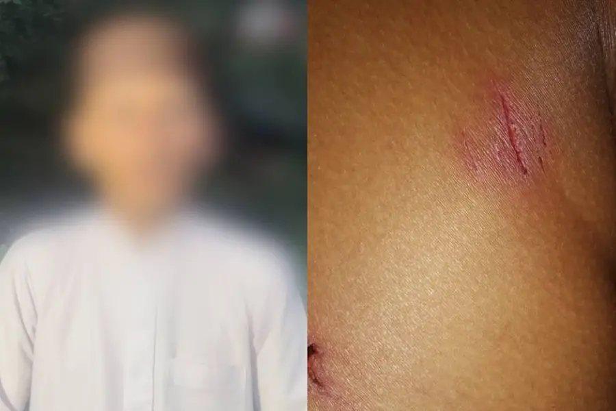 12കാരനെ മർദിച്ച സംഭവം; കാലിൽ ഈർക്കിൾ കയറ്റി, മുറിവിൽ നാരങ്ങാനീരും ഉപ്പും പുരട്ടിയിരുന്നു- സഹോദരൻ