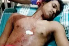 കുമ്മങ്കോട് അജ്ഞാതജീവിയുടെ ആക്രമണം; രണ്ടുപേർക്ക് പരിക്ക്