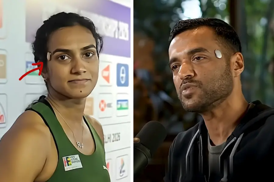 നെറ്റിയിൽ പതിപ്പിച്ച വിചിത്ര വസ്തു എന്താണ്? എന്തിന് വേണ്ടിയാണിത്? ടെമ്പിളിനെ കുറിച്ചറിയാം