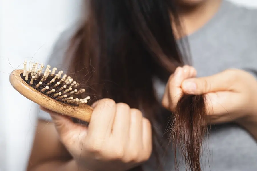 Hair falling more than usual? Here’s how stress could be connected