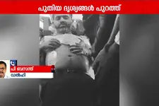 ഫ്ലൈ ദുബായ് വിമാനത്തിലെ ആക്രമണം: പരിക്കേറ്റ ക്യാപ്റ്റൻ സ്മിത്ത് മച്ചാറിന്റെ ദൃശ്യങ്ങൾ പുറത്ത്