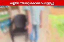 കാട്ടാക്കടയിൽ ക്രൂരത: ബഡ്സ്കൂൾ വിദ്യാർത്ഥിയുടെ കൈ സിഗരറ്റ് കൊണ്ട് പൊള്ളിച്ചു