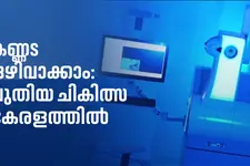 കണ്ണട ഇനി വേണ്ട; അത്യാധുനിക സ്മൈൽ പ്രോ ചികിത്സയുമായി കോഴിക്കോട് അബേറ്റ്