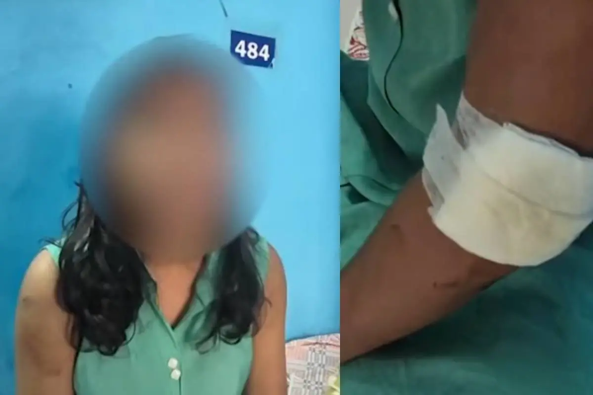 The woman's injuries following the alleged dowry-related assaults
