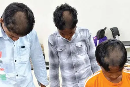 മുടിമുറിക്കുന്ന സമയത്ത് കളിക്കാൻ പോയി: 82 വിദ്യാർഥികൾക്ക് ‘പാതി മൊട്ടയടി’ ശിക്ഷ