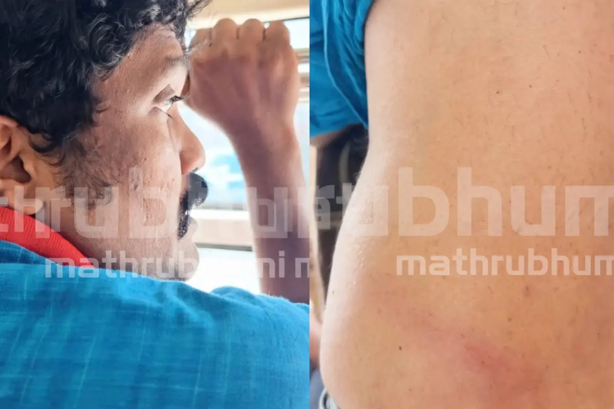 എ.എ. റഹിം എംപി കസ്റ്റഡിയിൽ, റഹിമിന്റെ ദേഹത്ത് മർദനമേറ്റ പാടുകൾ