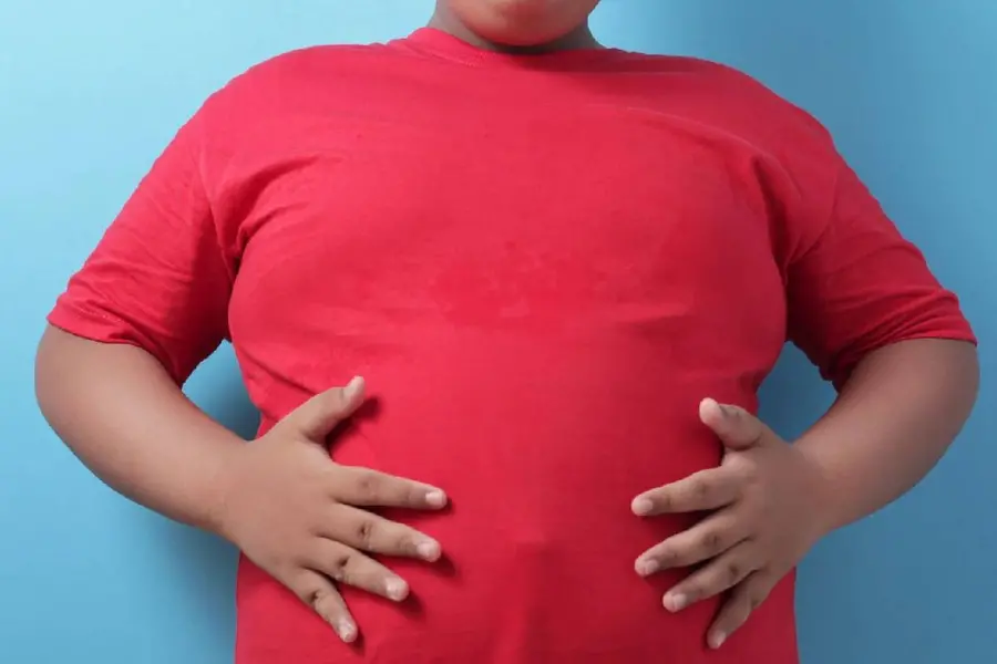 Obesity