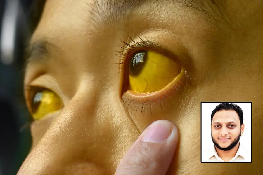 One dead, over 100 infected in jaundice outbreak linked to Wandoor hotel