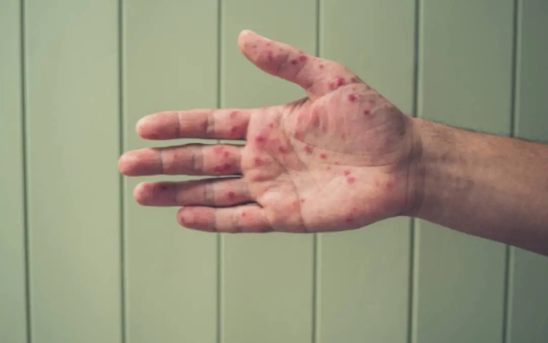 Representative Image| Photo: Canva.com