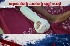 വർക്കലയിൽ പതിനേഴുകാരന് പോലീസിന്റെ ക്രൂരമർദ്ദനം; കാലിന്റെ എല്ല് പൊട്ടി