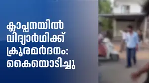 ക്ലാപ്പനയിൽ പ്ലസ് വൺ വിദ്യാർഥിക്ക് ക്രൂരമർദനം: കൈയൊടിച്ചു; ഏഴംഗ സംഘത്തിനെതിരെ കേസ്