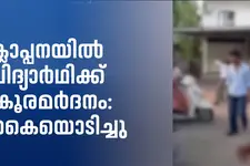 ക്ലാപ്പനയിൽ പ്ലസ് വൺ വിദ്യാർഥിക്ക് ക്രൂരമർദനം: കൈയൊടിച്ചു; ഏഴംഗ സംഘത്തിനെതിരെ കേസ്
