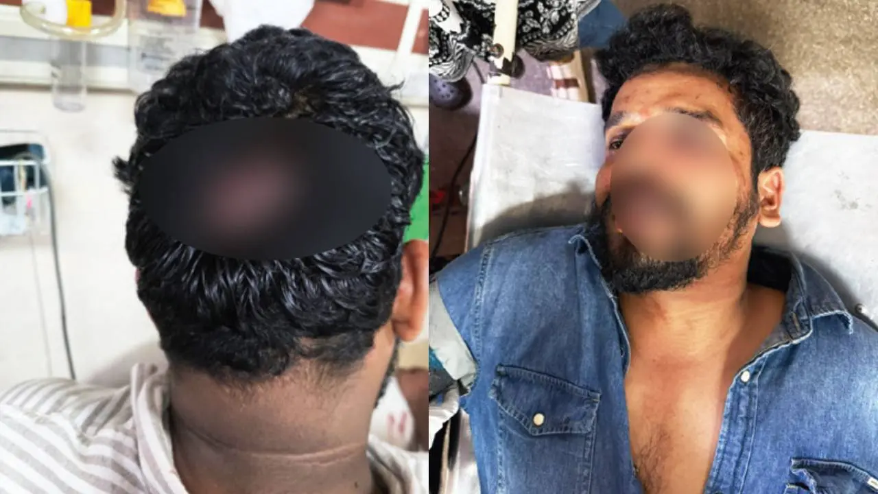 എസ്.എഫ്.ഐ. സംസ്ഥാന ജോയിന്റ് സെക്രട്ടറി എൻ. ആദിൽ തലയ്ക്കു പരിക്കേറ്റനിലയിൽ | മലപ്പുറം ജില്ലാ പ്രസിഡന്റ് എം. സുജിൻ തലയ്ക്കും മൂക്കിനും പരിക്കേറ്റനിലയിൽ