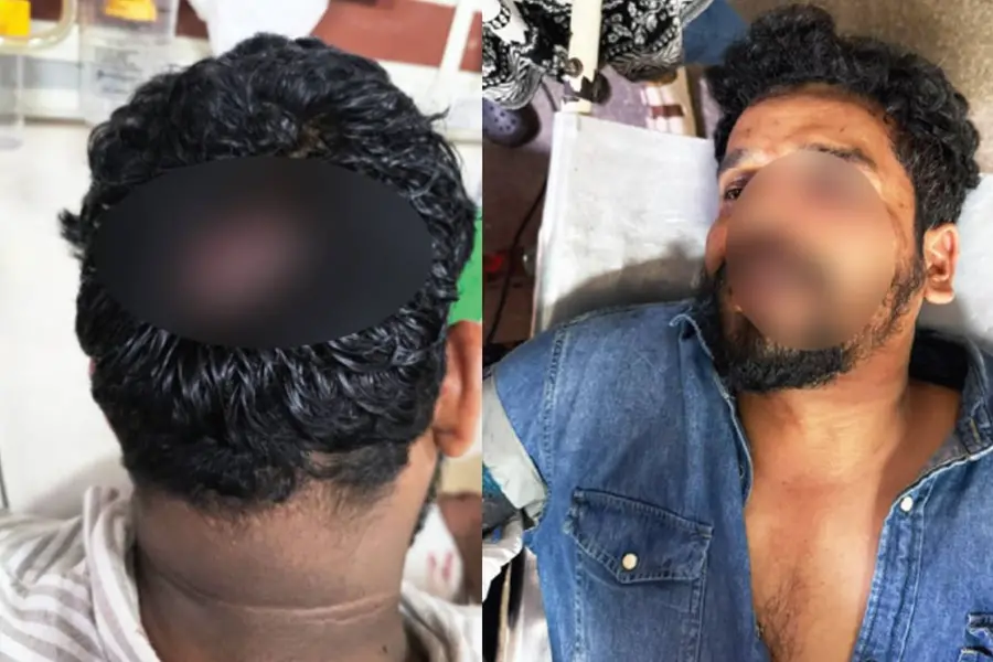 കാലിക്കറ്റ് സർവകലാശാലയിലെ സംഘർഷം; MSF പ്രവർത്തകർ SFI നേതാക്കളെ ആശുപത്രിയിൽ കയറി ആക്രമിച്ചതായി പരാതി